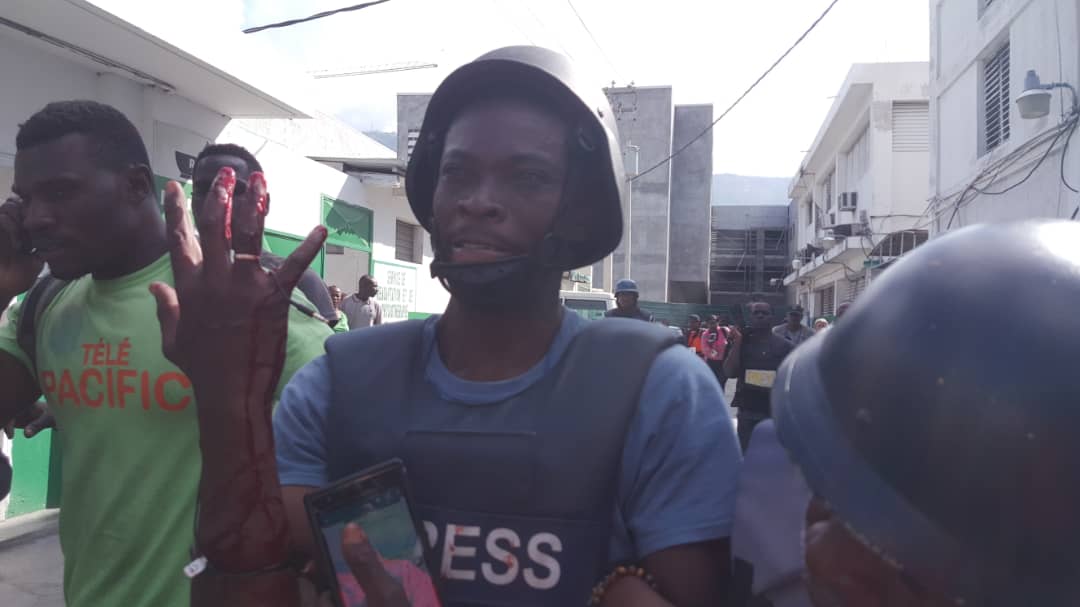 Le journaliste Robenson Sanon blessé par balle lors de manifestations anti-gouvernementales…
