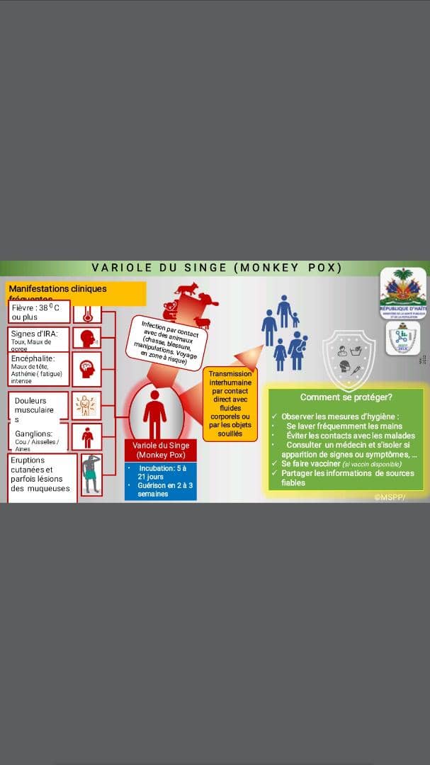 Haïti : les cas suspects de variole du singe sont négatifs
