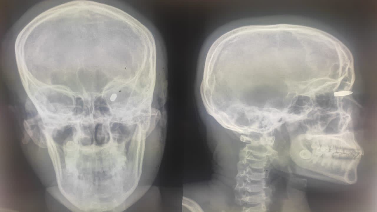 Les balles perdues de la République