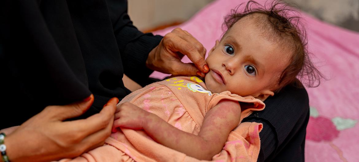 Le PAM appelle à des investissements urgents pour prévenir la malnutrition des enfants