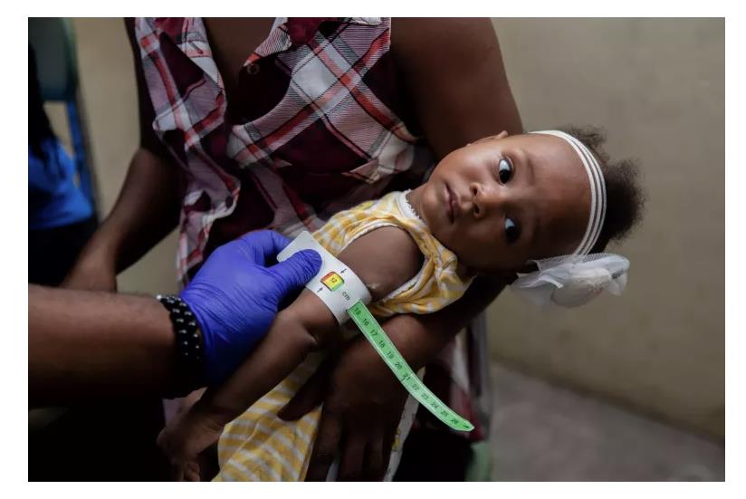 Haïti: plus d'un million d'enfants victimes d'insécurité alimentaire, selon l'Unicef